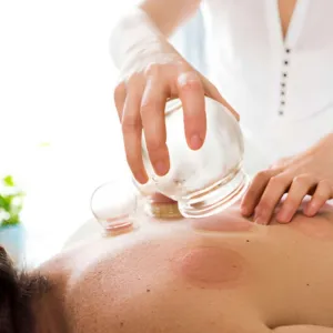 Dry Cupping in Bradford — a complementary treatment using suction cups on the skin.
